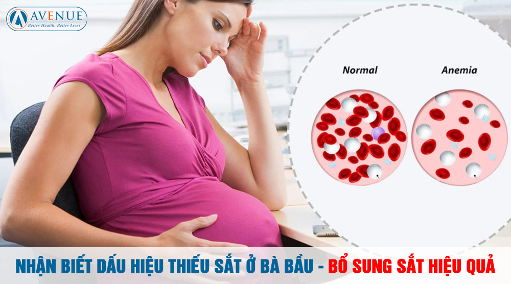Nhận Biết Dấu Hiệu Thiếu Sắt Ở Bà Bầu - Bổ Sung Sắt Hiệu Quả