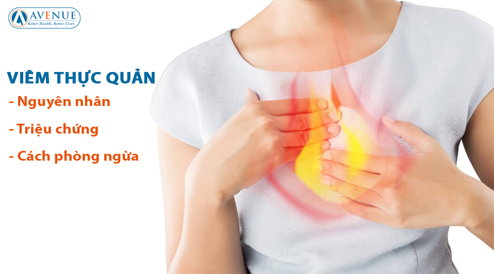 Viêm Thực Quản: Nguyên Nhân, Triệu Chứng và Phòng Ngừa Hiệu Quả (en)